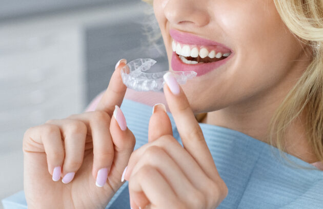 What are SureSmile® Clear Aligners?