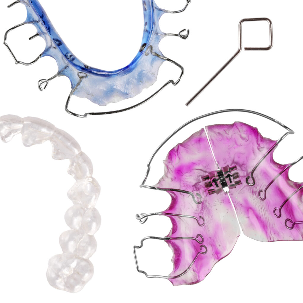 Understanding Retainers