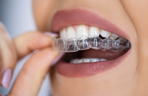 When Your Retainer Tightens: Navigating the Next Steps